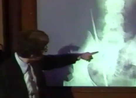 John Meurig Thomas pointing at a projection of an x-ray