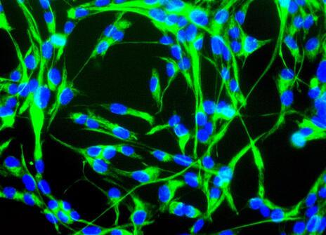 Neural stem cells with blue bodies and long green tails, on a black backdrop