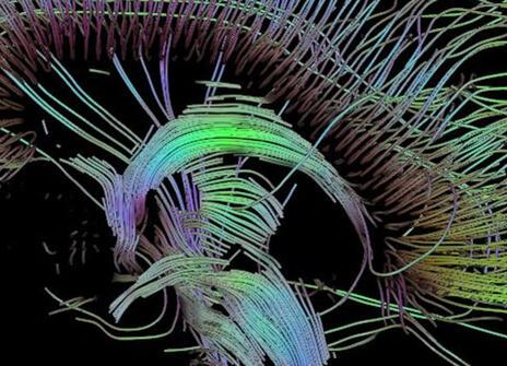 
An image of neural pathways in the brain taken using diffusion tensor imaging, developed at the University of Utah.
